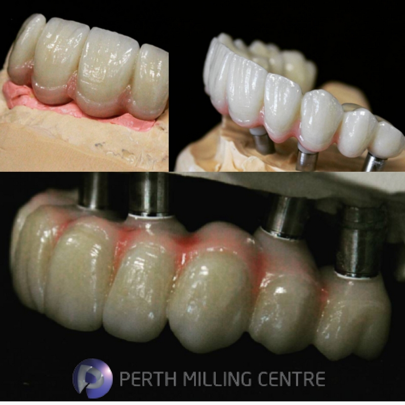 Dental Lab in Perth
